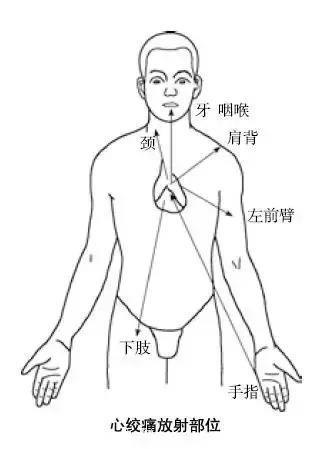 警惕！冠心病的十大蛛丝马迹