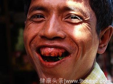 中年男子每天一包槟榔患舌癌，舌头切掉一半用大腿肉补上，苦不堪言！
