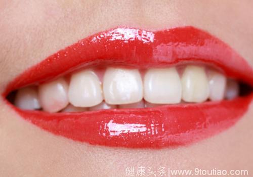 深圳麦芽口腔知识分享：牙齿颜色不好看是不是都可以做牙齿贴面？
