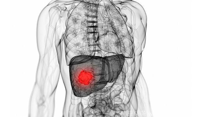 医生告诫：肝脏不好会发出5个信号，3招能护肝！