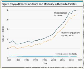 美国预防服务工作组：对无症状人员进行甲状腺癌筛查导致的危害超过获益