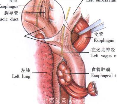 这个部位越窄 食管癌偏偏越喜欢！