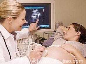 初次怀孕孕妈需要多久做第一次检查？B超需要做吗？