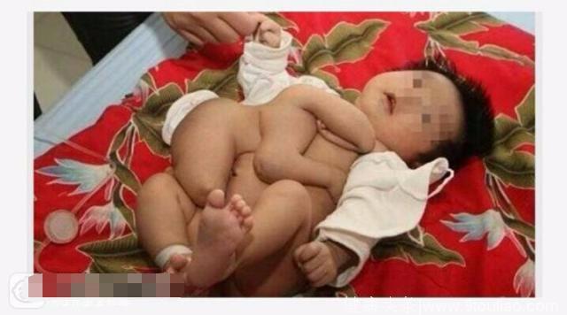 医生看见刚出生的婴儿抱着这东西吓坏了！知道结果后父母都痛哭了