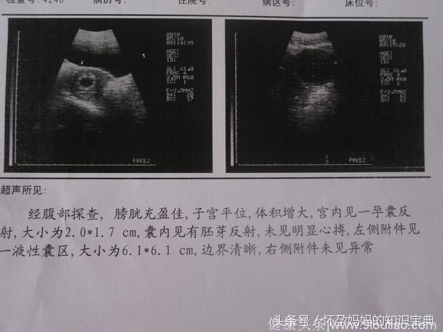 怀孕三个月生男孩的21条征兆