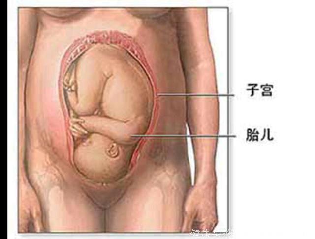 为什么有些孕妇不显怀，而有的肚子特别明显？