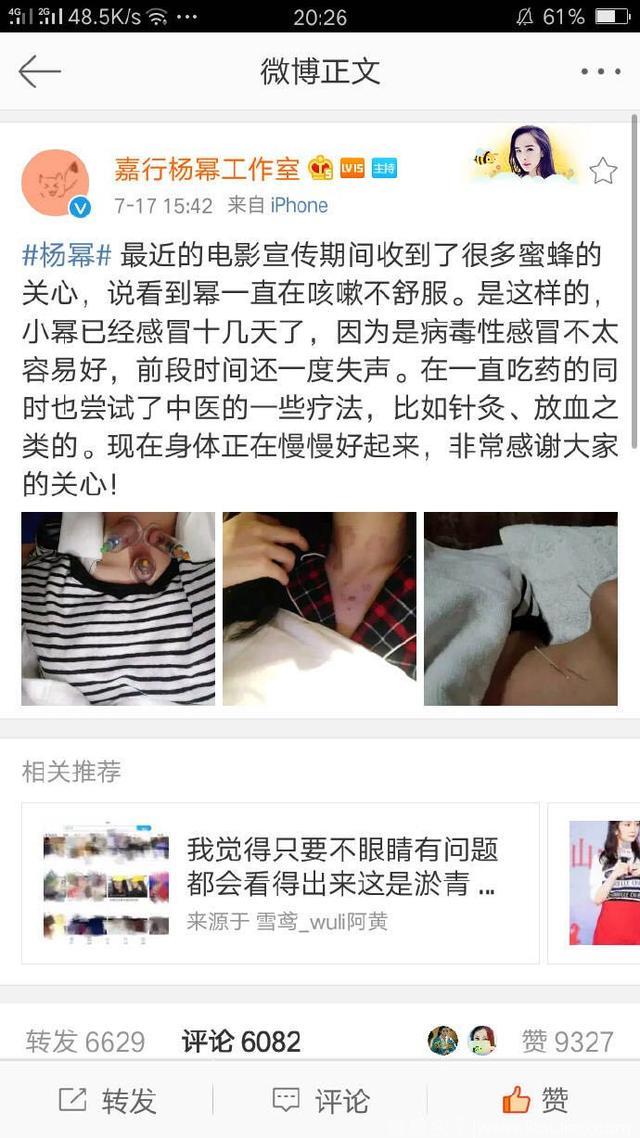 科普！独家揭秘杨幂颈部针灸放血疗法之中国传统针灸