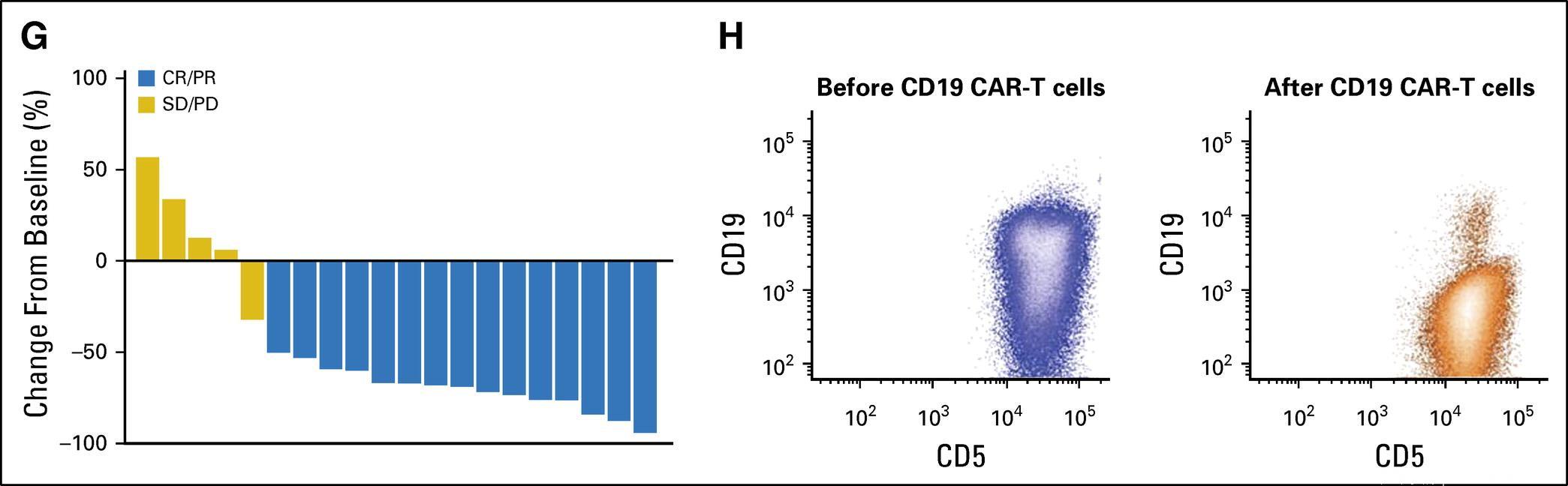 研究发现CAR-T细胞治疗在依鲁替尼失败后的高风险白血病患者中高度有效