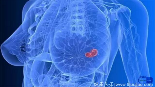 小康每日说：哪些情况下乳腺癌患者会用到阿那曲唑片？