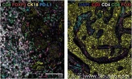 Science子刊封面：免疫疗法再立功！有望攻克难治乳腺癌