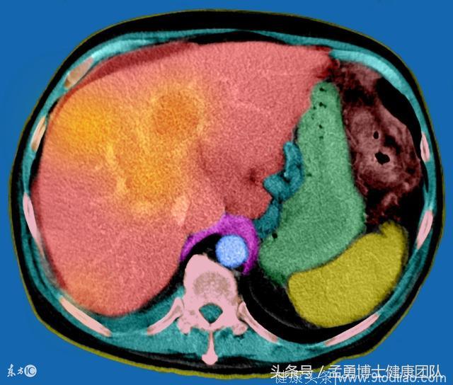 又一个生命因癌消逝！它，凭什么被称为“癌症之王”？