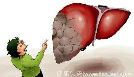 健康讲座肝脏篇十九：肝炎不可怕，就怕肝硬化，如何阻止其发展