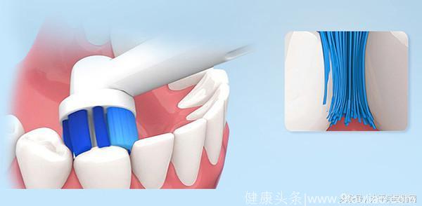 如何挑选第一支电动牙刷 4款懂你牙龈的牙刷推荐