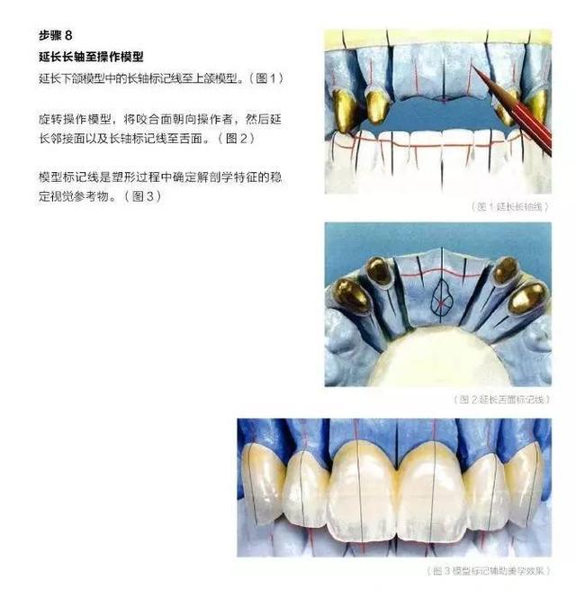 “牙齿塑形”到底有多美？看完你就知道了（一）｜Aidite 科教特辑