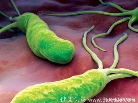 感染胃癌的主要致病菌幽门螺旋杆菌，在家可以检测吗？