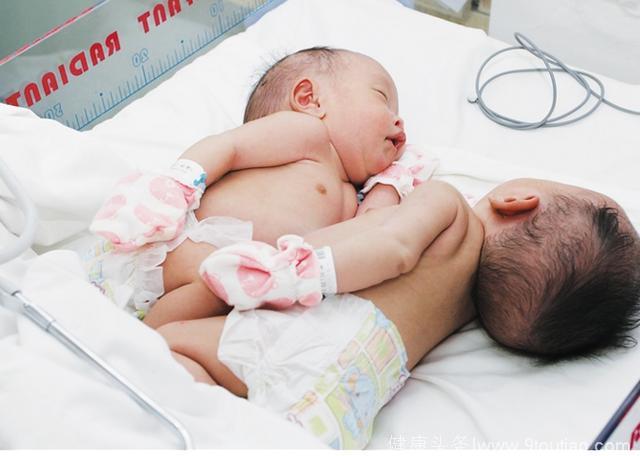 28岁孕妇辛苦怀上双胞胎，产检得知连体，坚持生下来后收获惊喜