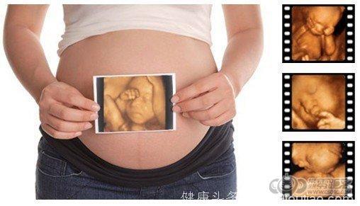 已经怀孕或者是家里有人怀孕的看过来，武汉生育险解读