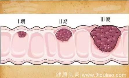 我真的没跟你开玩笑，牙齿不好可能引起口腔癌！