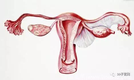 子宫肌瘤为什么偏爱美女？子宫肌瘤的九大疑问！
