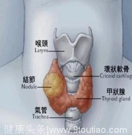 甲状腺结节的病因及症状有哪些？