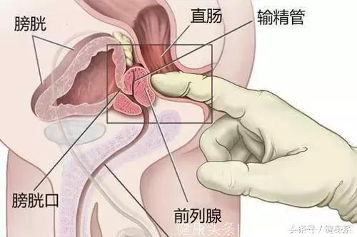 很多朋友都会骑单车，但是你们知道单车对于男性朋友来说有多重要吗？前列腺君要注意