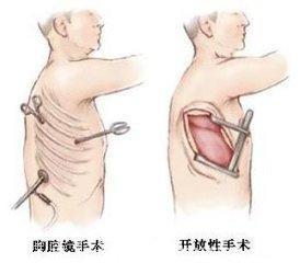 5大趋势，帮助我们掌握肺癌治疗的逆转机会