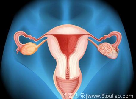 女人出现这3个症状，说明离宫颈癌更近了！