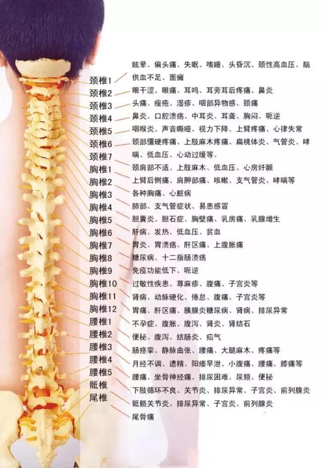 详细图解脊椎（颈椎、胸椎、腰椎）可能引起的108种疾病，太全面了，强烈建议收藏