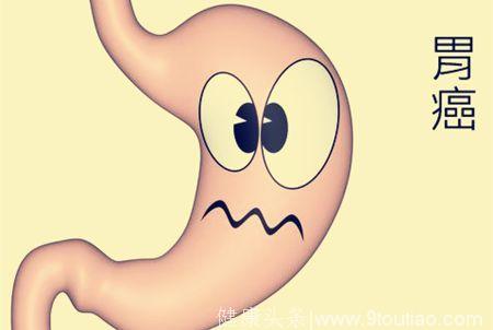 胃部出现这些不适症状，我怎么判断是不是胃癌？