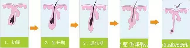 根治脱发，还得干细胞！干细胞技术治疗脱发大获成功！