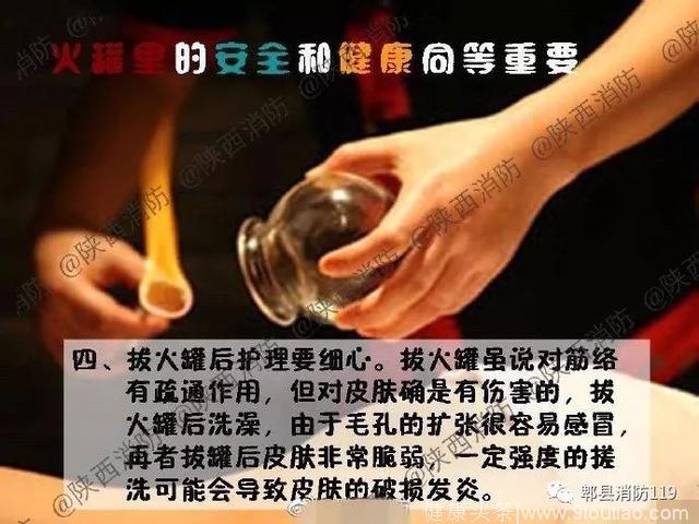 火罐里的安全和健康同等重要