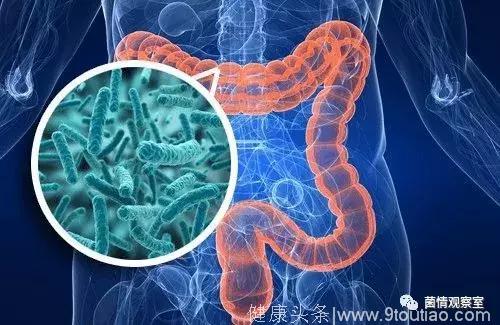 两种肠道细菌联手共同推动结肠癌的发生