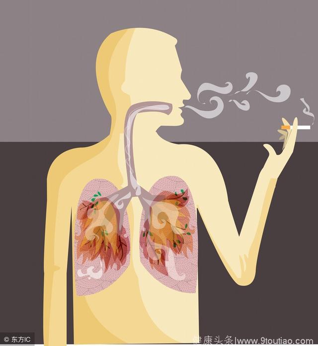 肺癌的早期症状有哪些？