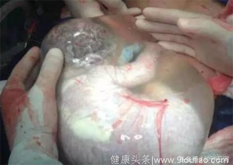 女子怀胎十月，生下一个“小哪吒”，医生看着都觉得奇怪