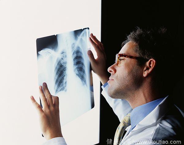 查出肺小结节就是癌症后备军？专家详细说给你听