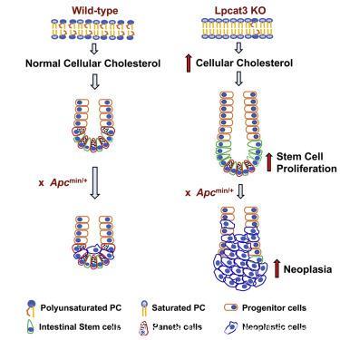 高胆固醇饮食与癌症有关，原来是“干细胞”在捣鬼！