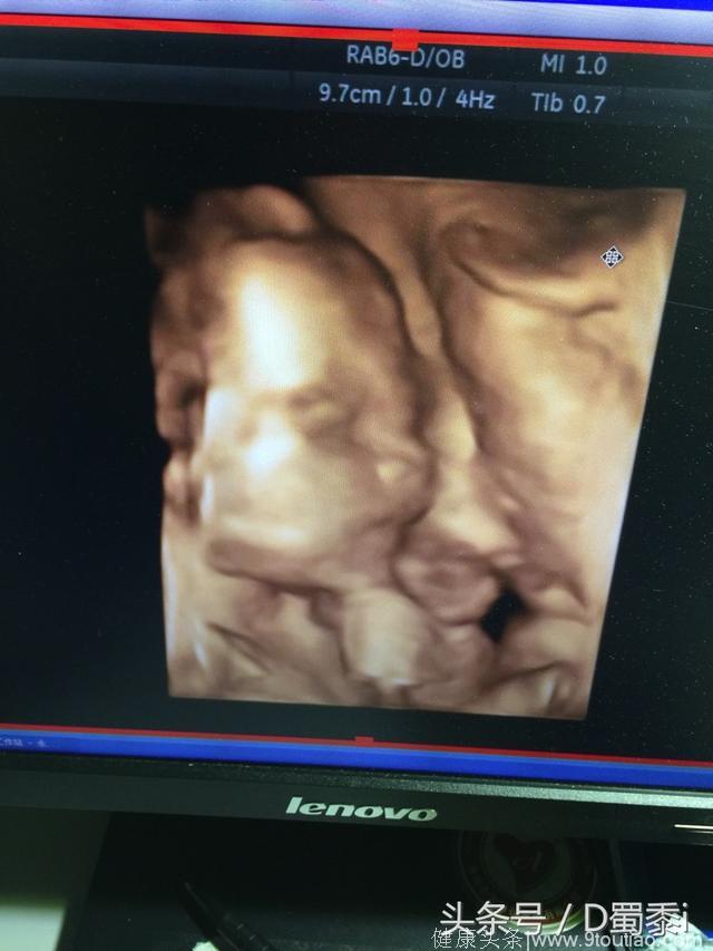 一胎千金，二胎男宝，分享一下我的孕期症状以及测试男宝的准确性