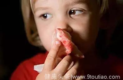 什么原因引起孩子“鼻出血”？止血和预防方法是什么？