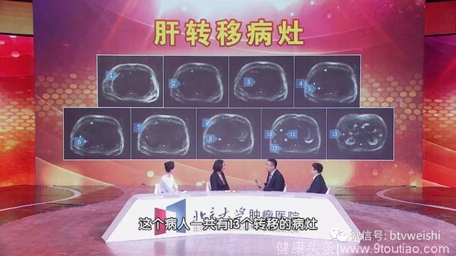 「养生堂」今日17:25播出《被治愈的癌症晚期》