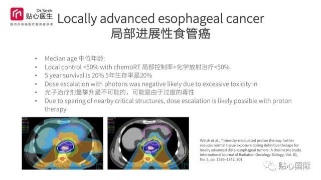 质子治疗—最好的癌症治疗权威案例