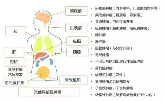 质子治疗—最好的癌症治疗权威案例