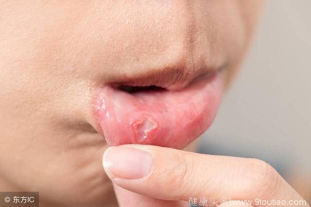 口干舌燥是怎么回事，如何快速解决？专家来支招
