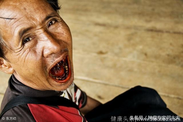 拒嚼槟榔：50%的口腔癌与嚼槟榔有关，全球7亿人还在嚼，该醒醒了