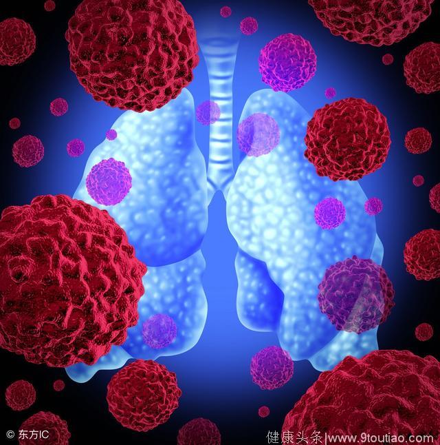 肺癌不断恶化会出现哪些部位的转移呢
