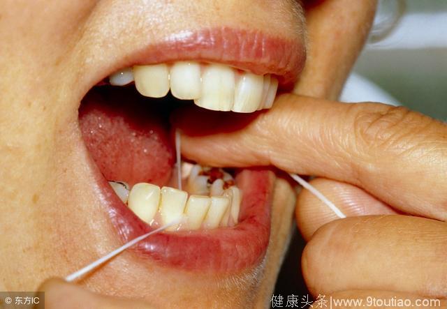刷牙流血也可能是癌症前兆，关于这个问题你注意过吗？