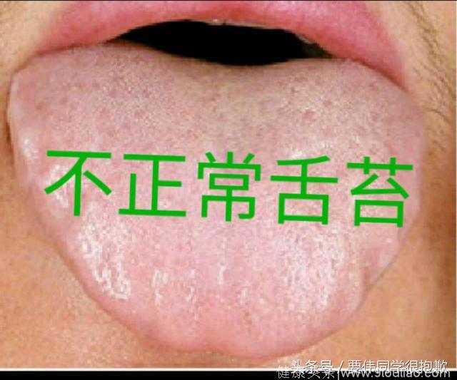 治愈早泄的根本在于舌苔的变化