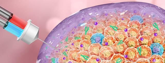 这次是“智能凝胶”，顾臻团队癌症免疫疗法新成果登Science子刊
