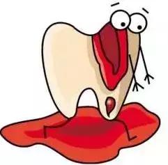 牙齿牙龈都没有伤口，为什么口腔会经常有血？