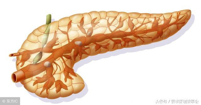 胰腺癌是癌症之王，医生说这四种损伤胰腺的食物一定不能吃！