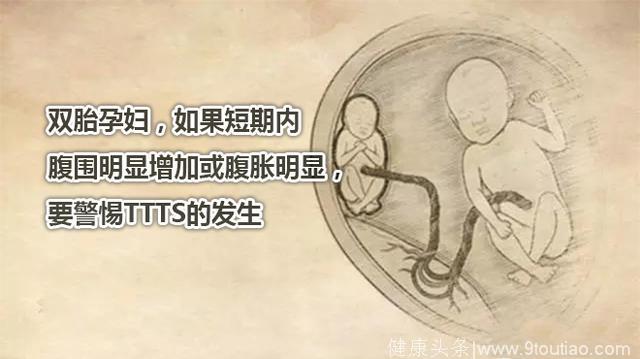 双胎孕妇，如果短期内腹围明显增加或腹胀明显，要警惕TTTS的发生